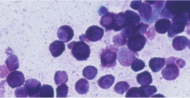 mast-cell