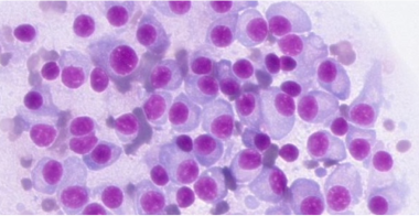 plasma-cell