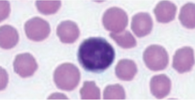 feline-lymphocyte
