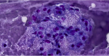 adipose-tissue