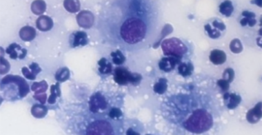 inflammatory
