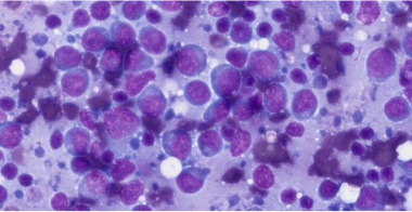 large-cell