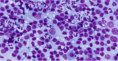 inflammatory