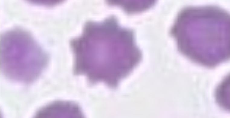 echinocyte