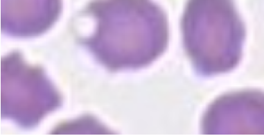 keratocyte