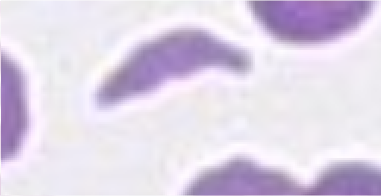 schistocyte