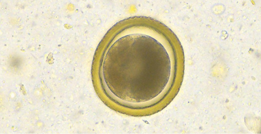 roundworms