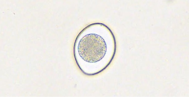 cystoisospora