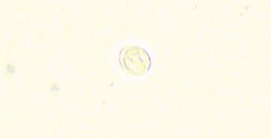 giardia