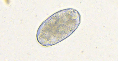hookworms