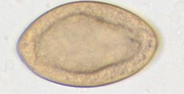 spirometra spp.