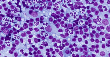 lymph-node